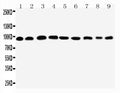 Anti-Plakophilin 2/PKP2 Antibody Picoband®