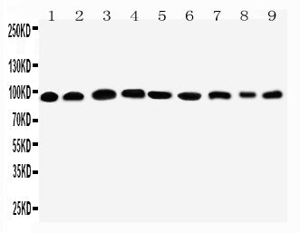 Anti-Plakophilin 2/PKP2 Antibody Picoband®