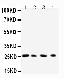 Anti-Rab3C antibody, PA2279, All Western blotting
All lanes: Anti-RAB3C(PA2279) at 0.5ug/ml

Lane 1: Rat Brain Tissue Lysate at 40ug

Lane 2: HELA Whole Cell Lysate at 40ug

Lane 3: 293T Whole Cell Lysate at 40ug

Lane 4: COLO320 Whole Cell Lysate at 40ug

Predicted bind size: 26KD

Observed bind size: 26KD