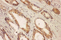 Anti-Ras-related protein Rab-8A RAB8A Antibody Picoband®