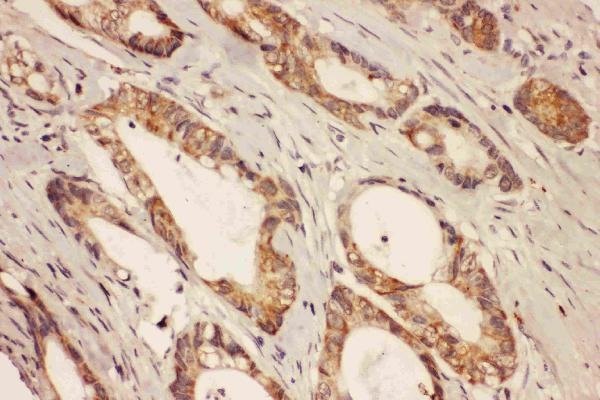 Anti-Ras-related protein Rab-8A RAB8A Antibody Picoband®