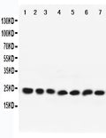 Anti-Rab9 antibody, PA2281, All Western blotting
All lanes: Anti-RAB9A(PA2281) at 0.5ug/ml

Lane 1: Rat Brain Tissue Lysate at 40ug

Lane 2: Mouse Brain Tissue Lysate at 40ug

Lane 3: HELA Whole Cell Lysate at 40ug

Lane 4: PC12 Whole Cell Lysate at 40ug

Lane 5: NIH Whole Cell Lysate at 40ug

Lane 6: A431 Whole Cell Lysate at 40ug

Lane 7: 293T Whole Cell Lysate at 40ug

Predicted bind size: 23KD

Observed bind size: 23KD