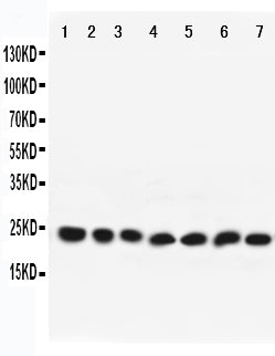 Anti-Rab9 antibody, PA2281, All Western blotting
All lanes: Anti-RAB9A(PA2281) at 0.5ug/ml

Lane 1: Rat Brain Tissue Lysate at 40ug

Lane 2: Mouse Brain Tissue Lysate at 40ug

Lane 3: HELA Whole Cell Lysate at 40ug

Lane 4: PC12 Whole Cell Lysate at 40ug

Lane 5: NIH Whole Cell Lysate at 40ug

Lane 6: A431 Whole Cell Lysate at 40ug

Lane 7: 293T Whole Cell Lysate at 40ug

Predicted bind size: 23KD

Observed bind size: 23KD