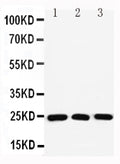 Anti-Ras-related protein Rab-11A Rab11A Antibody Picoband®