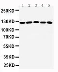 Anti-ST5 antibody, PA2287, All Western blotting
All lanes: Anti-ST5(PA2287) at0.5ug/ml
Lane 1: Rat Testis Tissue Lysate at 40ug
Lane 2: A431 Whole Cell Lysate at 40ug
Lane 3: HELA Whole Cell Lysate at 40ug
Lane 4: COLO320 Whole Cell Lysate at 40ug
Lane 5: NIH/3T3 Whole Cell Lysate at 40ug
Predicted bind size: 126KD
Observed bind size: 126KD