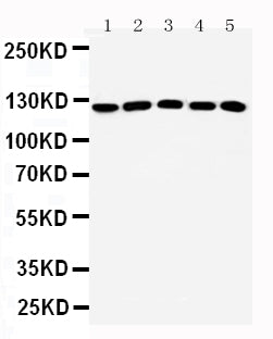 Anti-ST5 antibody, PA2287, All Western blotting
All lanes: Anti-ST5(PA2287) at0.5ug/ml
Lane 1: Rat Testis Tissue Lysate at 40ug
Lane 2: A431 Whole Cell Lysate at 40ug
Lane 3: HELA Whole Cell Lysate at 40ug
Lane 4: COLO320 Whole Cell Lysate at 40ug
Lane 5: NIH/3T3 Whole Cell Lysate at 40ug
Predicted bind size: 126KD
Observed bind size: 126KD