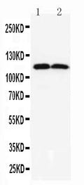 Anti-TMEM16A antibody, PA2290, All Western blotting
All lanes: Anti-ANO1(PA2290) at 0.5ug/ml

Lane 1: Rat Liver Tissue Lysate at 40ug

Lane 2: Rat Skeletal Muscle Tissue Lysate at 40ug

Predicted bind size: 114KD

Observed bind size: 114KD