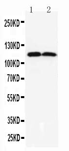 Anti-TMEM16A antibody, PA2290, All Western blotting
All lanes: Anti-ANO1(PA2290) at 0.5ug/ml

Lane 1: Rat Liver Tissue Lysate at 40ug

Lane 2: Rat Skeletal Muscle Tissue Lysate at 40ug

Predicted bind size: 114KD

Observed bind size: 114KD