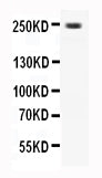 Anti-CaV1.3 antibody, PA2293, All Western blotting
All lanes: Anti-CACNA1D(PA2293) at 0.5ug/ml

Lane 1: Rat Brain Tissue Lysate at 40ug

Predicted bind size: 245KD

Observed bind size: 245KD
