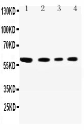 Anti-SynCAM antibody, PA2294, All Western blotting
All lanes: Anti-CADM1(PA2294) at 0.5ug/ml

Lane 1: A549 Whole Cell Lysate at 40ug

Lane 2: JURKAT Whole Cell Lysate at 40ug

Lane 3: RAJI Whole Cell Lysate at 40ug

Lane 4: HELA Whole Cell Lysate at 40ug

Predicted bind size: 60KD

Observed bind size: 60KD