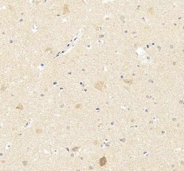 Anti-PSD95/DLG4 Antibody Picoband®
