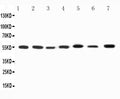 Anti-Kv1.1 potassium channel antibody, PA2296, All Western blotting
All lanes: Anti-KCNA1(PA2296) at 0.5ug/ml

Lane 1: Rat Brain Tissue Lysate at 40ug

Lane 2: Rat Testis Tissue Lysate at 40ug

Lane 3: Rat Cardiac Muscle Tissue Lysate at 40ug

Lane 4: HELA Whole Cell Lysate at 40ug

Lane 5: U87 Whole Cell Lysate at 40ug

Lane 6: SHG Whole Cell Lysate at 40ug

Lane 7: NEURO Whole Cell Lysate at 40ug

Predicted bind size: 56KD

Observed bind size: 56KD