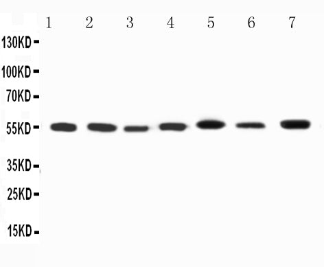 Anti-Kv1.1 potassium channel antibody, PA2296, All Western blotting
All lanes: Anti-KCNA1(PA2296) at 0.5ug/ml

Lane 1: Rat Brain Tissue Lysate at 40ug

Lane 2: Rat Testis Tissue Lysate at 40ug

Lane 3: Rat Cardiac Muscle Tissue Lysate at 40ug

Lane 4: HELA Whole Cell Lysate at 40ug

Lane 5: U87 Whole Cell Lysate at 40ug

Lane 6: SHG Whole Cell Lysate at 40ug

Lane 7: NEURO Whole Cell Lysate at 40ug

Predicted bind size: 56KD

Observed bind size: 56KD