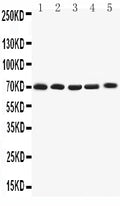 Anti-Kv1.4 antibody, PA2297, All Western blotting
All lanes: Anti-KCNA4(PA2297) at 0.5ug/ml

Lane 1: Rat Brain Tissue Lysate at 40ug

Lane 2: HY1080Whole Cell Lysate at 40ug

Lane 3: PANC Whole Cell Lysate at 40ug

Lane 4: U87 Whole Cell Lysate at 40ug

Lane 5: SHG Whole Cell Lysate at 40ug

Predicted bind size: 70KD

Observed bind size: 70KD