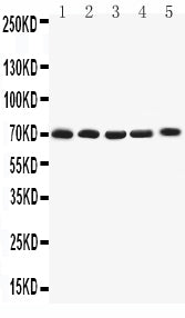 Anti-Kv1.4 antibody, PA2297, All Western blotting
All lanes: Anti-KCNA4(PA2297) at 0.5ug/ml

Lane 1: Rat Brain Tissue Lysate at 40ug

Lane 2: HY1080Whole Cell Lysate at 40ug

Lane 3: PANC Whole Cell Lysate at 40ug

Lane 4: U87 Whole Cell Lysate at 40ug

Lane 5: SHG Whole Cell Lysate at 40ug

Predicted bind size: 70KD

Observed bind size: 70KD