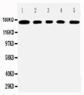 Anti-MUC1 antibody, PA2302, All Western blotting
All lanes: Anti-MUCIN1(PA2302) at 0.5ug/ml

Lane 1: COLO320 Whole Cell Lysate at 40ug

Lane 2: SW620 Whole Cell Lysate at 40ug

Lane 3: HEPG2 Whole Cell Lysate at 40ug

Lane 4: MCF-7 Whole Cell Lysate at 40ug

Lane 5: JURKAT Whole Cell Lysate at 40ug

Predicted bind size: 122KD

Observed bind size: 170KD
