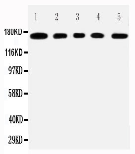 Anti-MUC1 antibody, PA2302, All Western blotting
All lanes: Anti-MUCIN1(PA2302) at 0.5ug/ml

Lane 1: COLO320 Whole Cell Lysate at 40ug

Lane 2: SW620 Whole Cell Lysate at 40ug

Lane 3: HEPG2 Whole Cell Lysate at 40ug

Lane 4: MCF-7 Whole Cell Lysate at 40ug

Lane 5: JURKAT Whole Cell Lysate at 40ug

Predicted bind size: 122KD

Observed bind size: 170KD