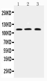 Anti-TRPC4 antibody, PA2307, All Western blotting
All lanes: Anti-TRPC4(PA2307) at 0.5ug/ml

Lane 1: COLO320 Whole Cell Lysate at 40ug

Lane 2: MCF-7 Whole Cell Lysate at 40ug

Lane 3: PANC Whole Cell Lysate at 40ug

Predicted bind size: 112KD

Observed bind size: 112KD