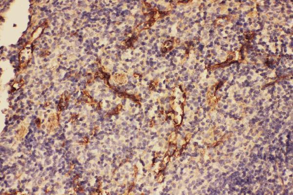 Anti-C5/C5a antibody, PA2308, IHC(P)
IHC(P): Mouse Spleen Tissue