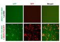 NR2F2 Reporter Lentivirus – Figure 1 of 7
