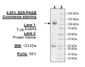 PARP9, GST-tag, His-tag Recombinant – Figure 1 of 1