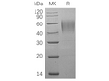 Recombinant Human ICAM-2/CD102 Protein (His Tag) – Figure 1 of 2