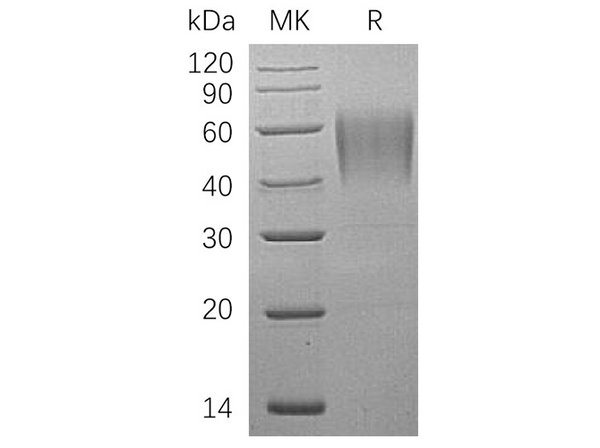 Recombinant Human ICAM-2/CD102 Protein (His Tag) – Figure 1 of 2