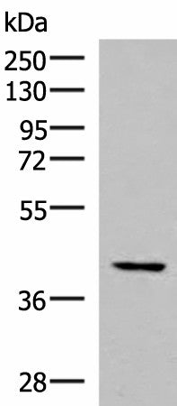 IST1 Polyclonal Antibody – Figure 1 of 3