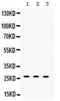 Anti-DDAH2 Antibody Picoband®