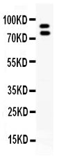 Anti-MMP9 Antibody Picoband®