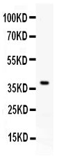 Anti-RANKL/TNFSF11 Antibody Picoband®