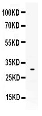 Anti-Mast Cell Tryptase/TPSAB1 Antibody Picoband®
