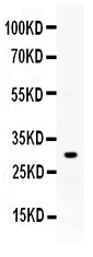 Anti-ZWINT Antibody Picoband®