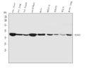 Anti-ACAA2 Antibody Picoband®