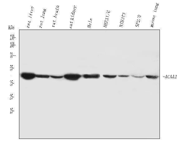 Anti-ACAA2 Antibody Picoband®