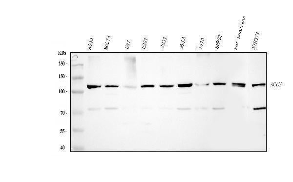 Anti-ATP citrate lyase/ACLY Antibody Picoband®