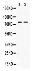 Anti-Activin Receptor Type IIA/ACVR2A Antibody Picoband®