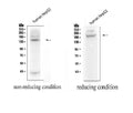 Anti-ADAMTS13 Antibody Picoband®