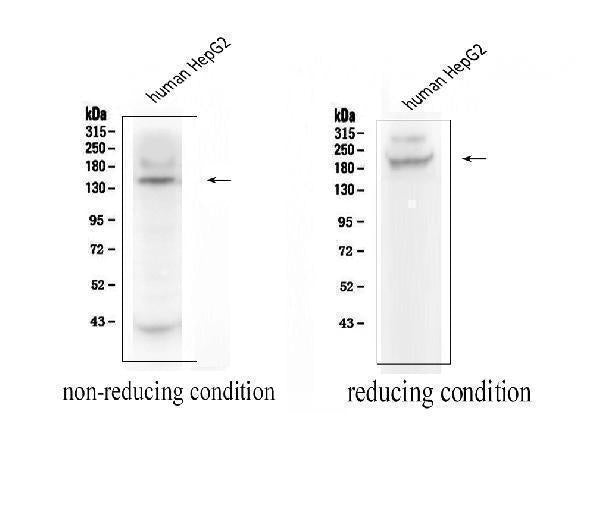 Anti-ADAMTS13 Antibody Picoband®