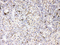 Anti-Apolipoprotein B/APOB Antibody Picoband®