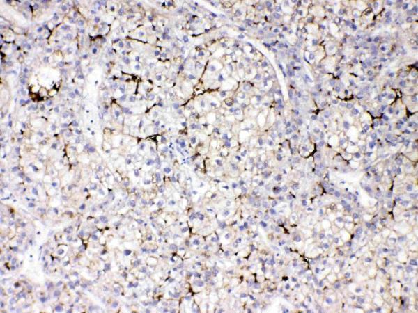 Anti-Apolipoprotein B/APOB Antibody Picoband®