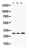 Anti-AQP11 Antibody Picoband®