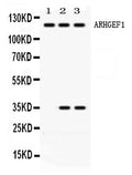Anti-ARHGEF1 Antibody Picoband®