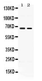 Anti-ACCN1/ASIC2 Antibody Picoband®