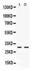 Anti-Carbonic Anhydrase III/CA3 Antibody Picoband®