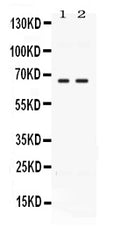 Anti-CCDC6 Antibody Picoband®