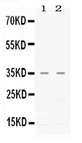 Anti-CXCL16 Antibody Picoband®