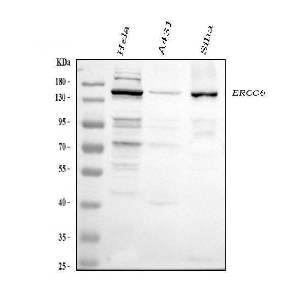 Anti-CSB/ERCC6 Antibody Picoband®