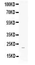Anti-FGF21 Antibody Picoband®