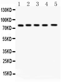 Anti-FSH Receptor/FSHR Antibody Picoband®